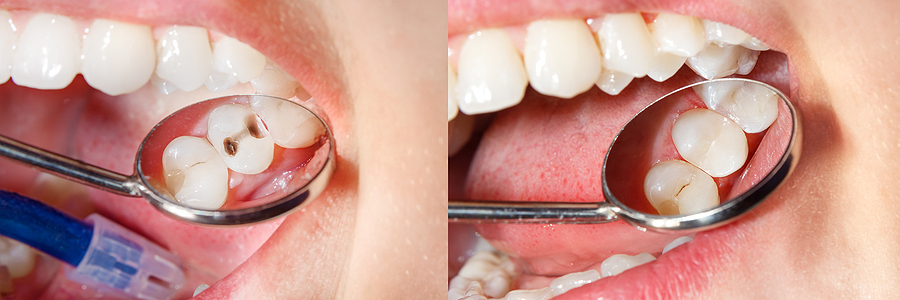 SoCalSmiles Dental Office SoCalSmiles Dental Office