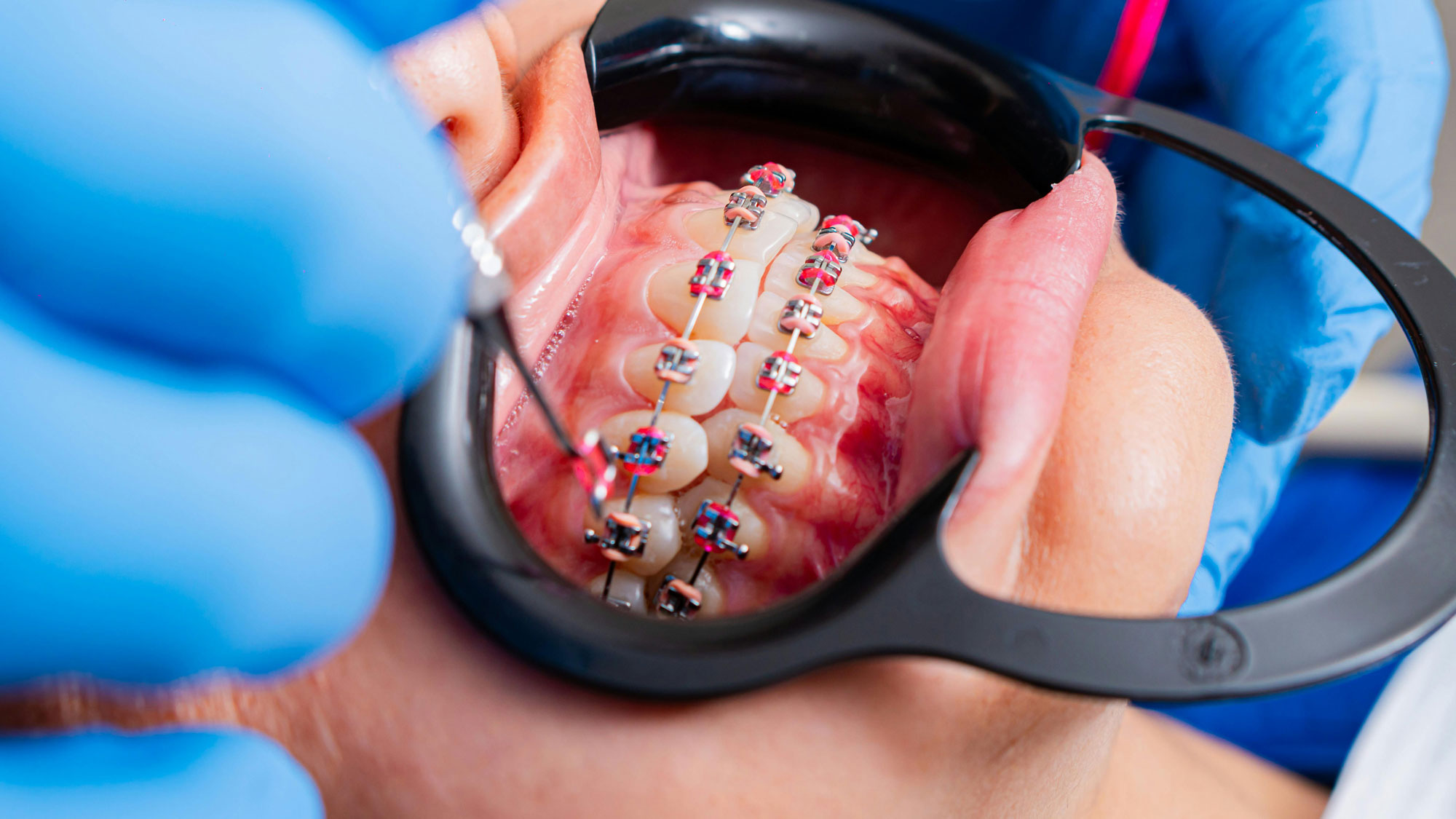 SoCalSmiles Dental Office SoCalSmiles Dental Office