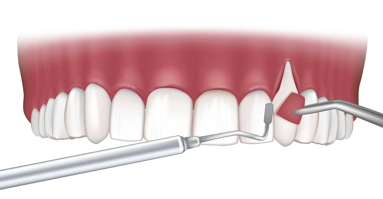 SoCalSmiles Dental Office SoCalSmiles Dental Office