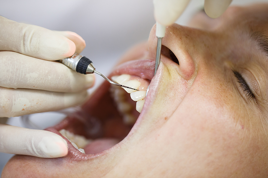 Your Complete Guide to Gum Health: 20 Common Periodontics FAQ in Tarzana, CA