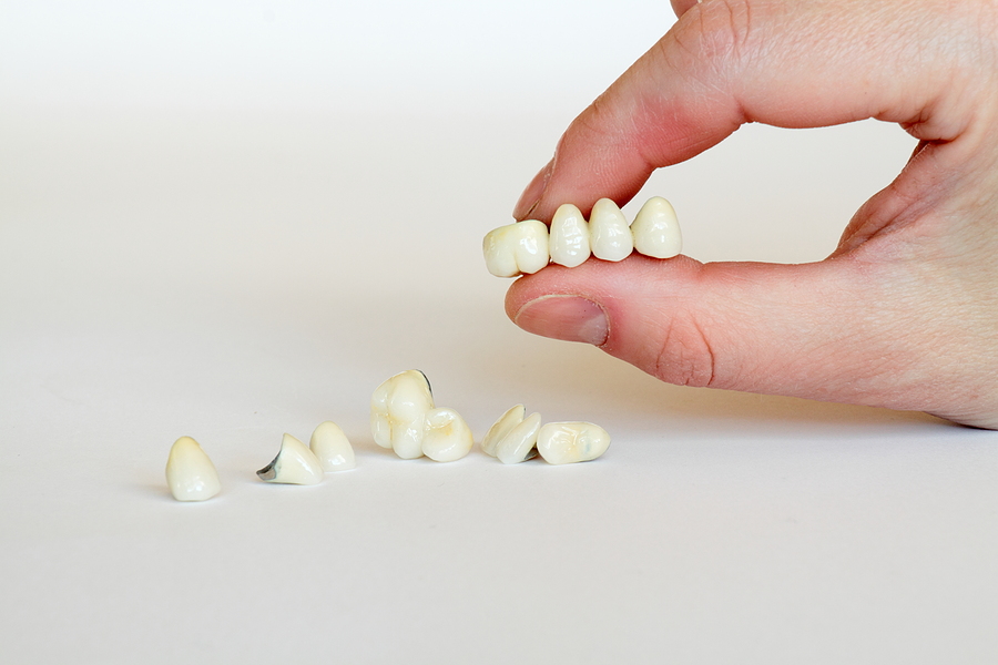 Restore Your Smile with Confidence: Benefits of Porcelain Dental Crowns in Tarzana, CA