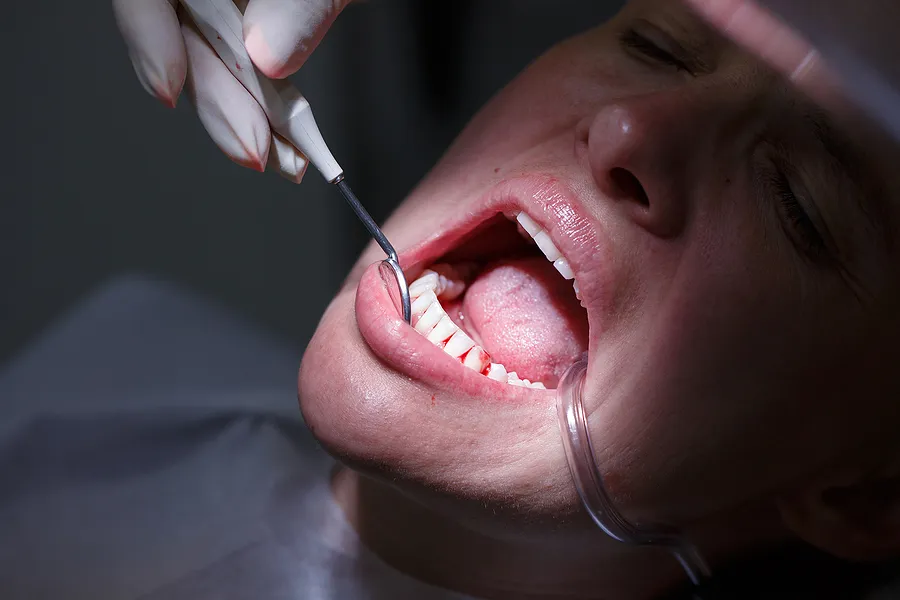 Comprehensive Guide to Periodontics: Protecting Your Gums and Smile in Tarzana, CA