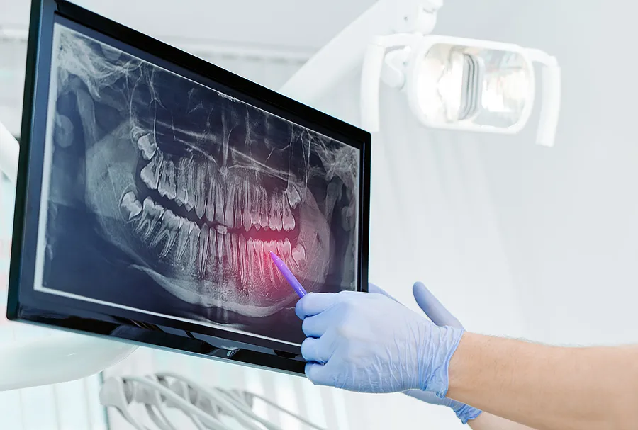 Revolutionizing Dental Diagnostics: The Importance of Digital X-Rays in Tarzana, CA